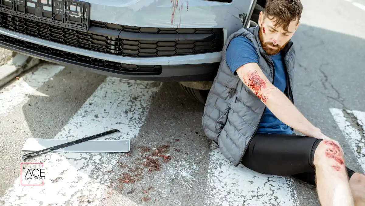 A Pedestrian got hit by a car